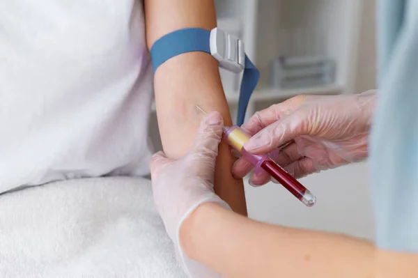 Blood Sample Collection at Home